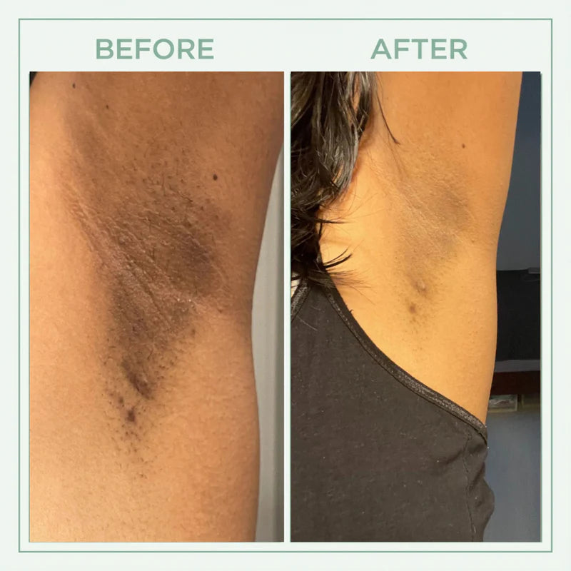 Core Skin™ Bright Peel Spray